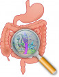 Gastroenteritis pada Anak