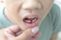 Mengurangi Rasa Takut Anak Saat Giginya Akan Tanggal